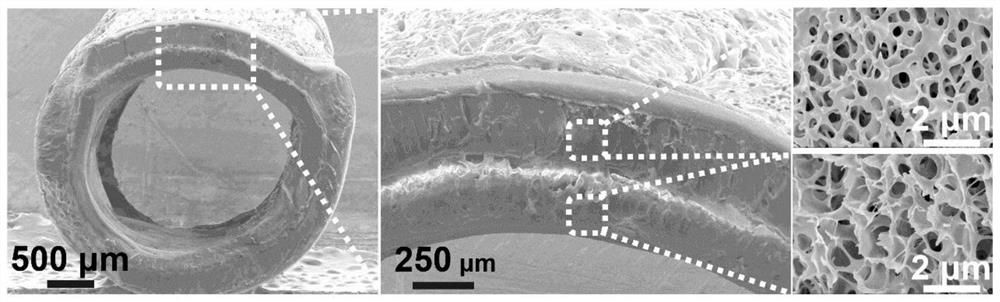 Hydrogel artificial blood vessel and preparation method thereof