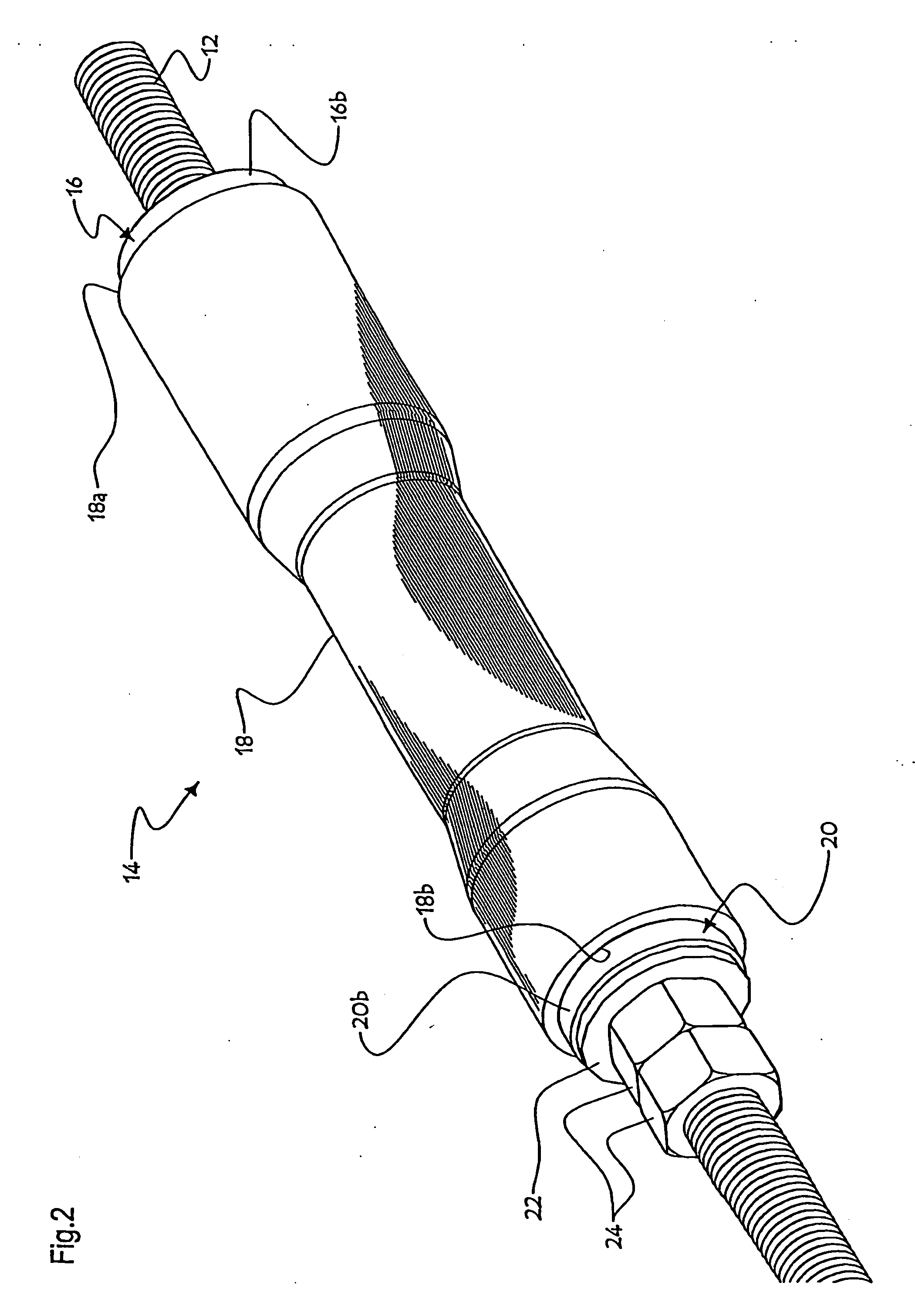 Anchor device with an elastic expansion sleeve