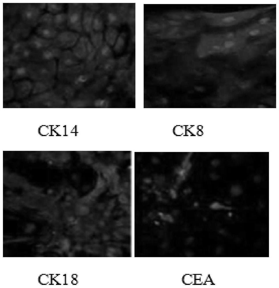 A method for inducing and differentiating sweat gland cells from epidermal stem cells and its medium group