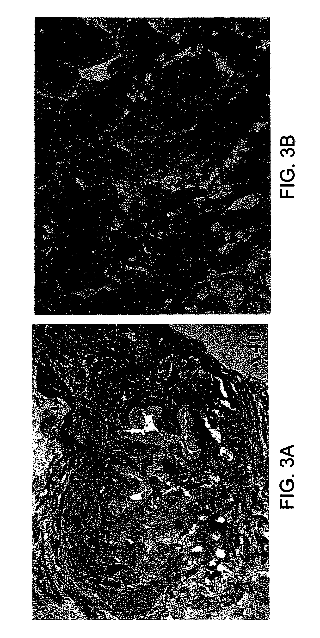Soft tissue and bone augmentation and bulking utilizing muscle-derived progenitor cells, compositions and treatments thereof