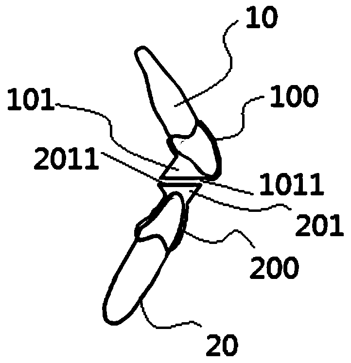 Orthodontic correction auxiliary device used for anterior teeth, and orthodontic correction device