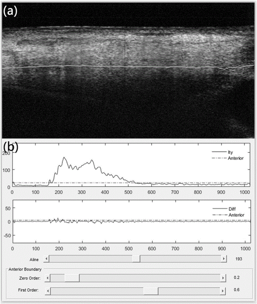 Angiography method applied to optical coherence tomography and OCT system