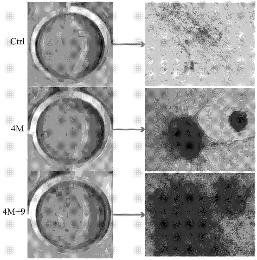 High-efficiency non-integrating human iPSC induction platform