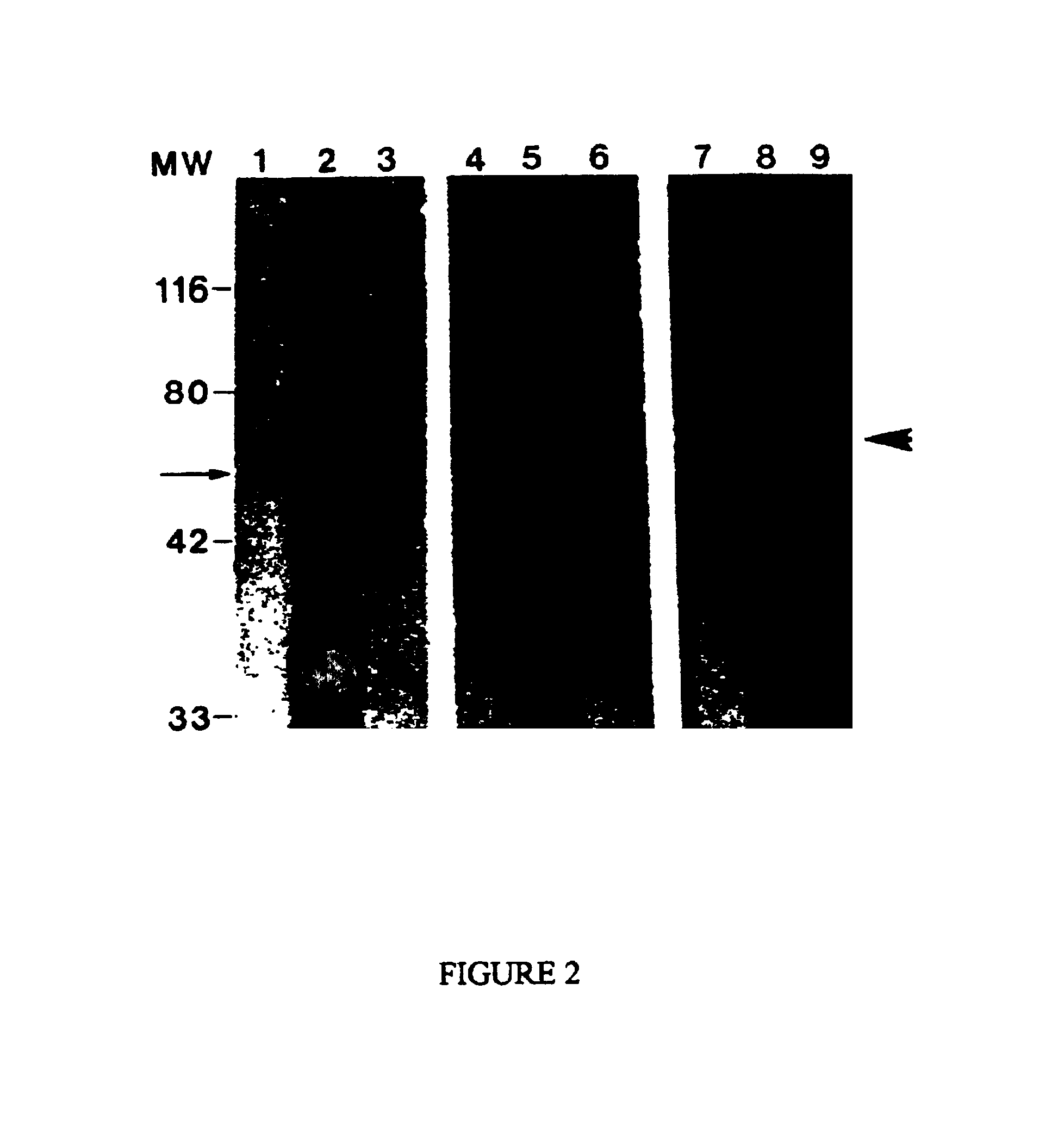 Purified antigen for Alzheimer's disease and methods of obtaining and using same