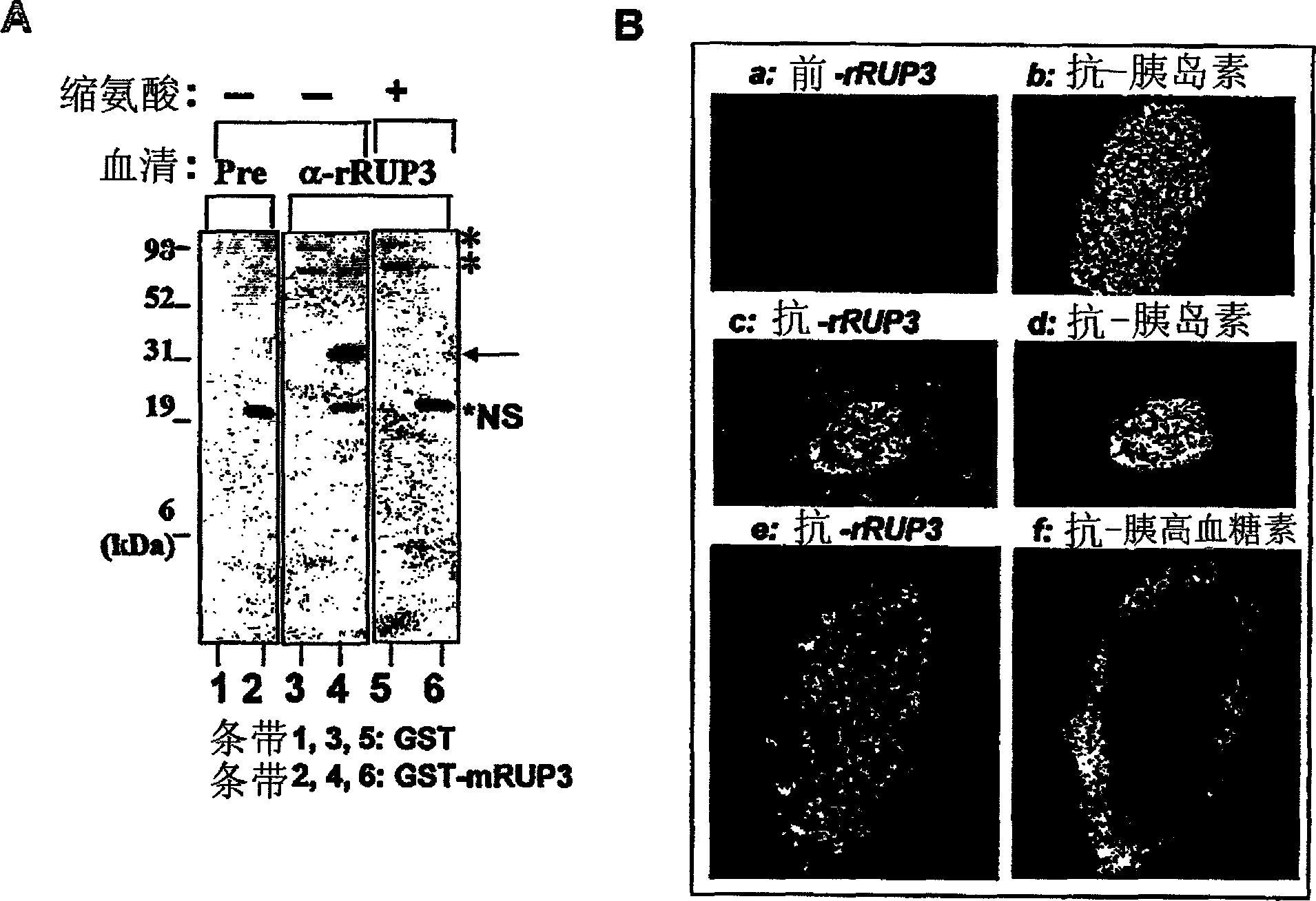 Fused-aryl and heteroaryl derivatives as modulators of metabolism and the prophylaxis and treatment of disorders related thereto