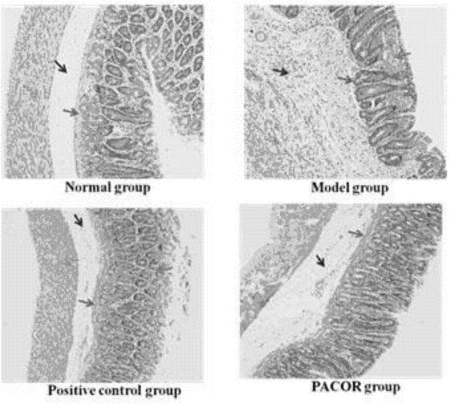 Application of Ovularia raphanipes extract in preparation of preparations used for treating and/or preventing diseases related to alteration of intestinal florae