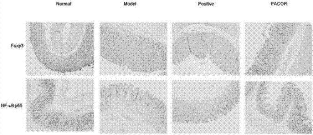 Application of Ovularia raphanipes extract in preparation of preparations used for treating and/or preventing diseases related to alteration of intestinal florae