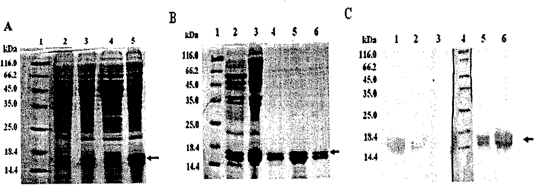 Therapeutic vaccine for Myostatin specific antibody and its preparation method