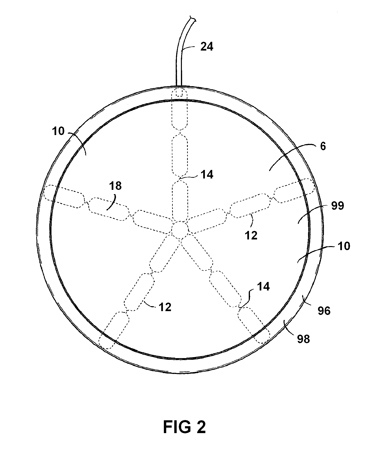Breast implant with adjustable compression response