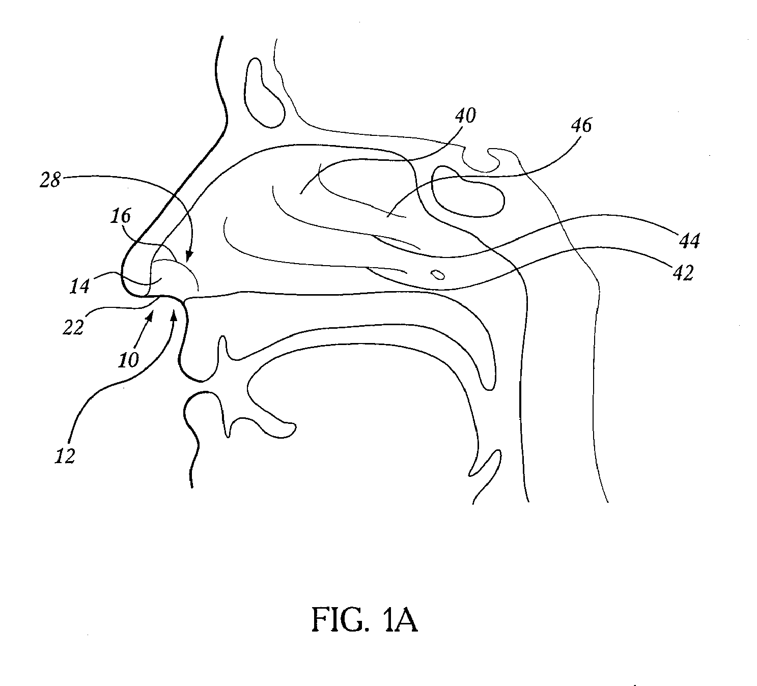 Devices and methods for targeted nasal phototherapy