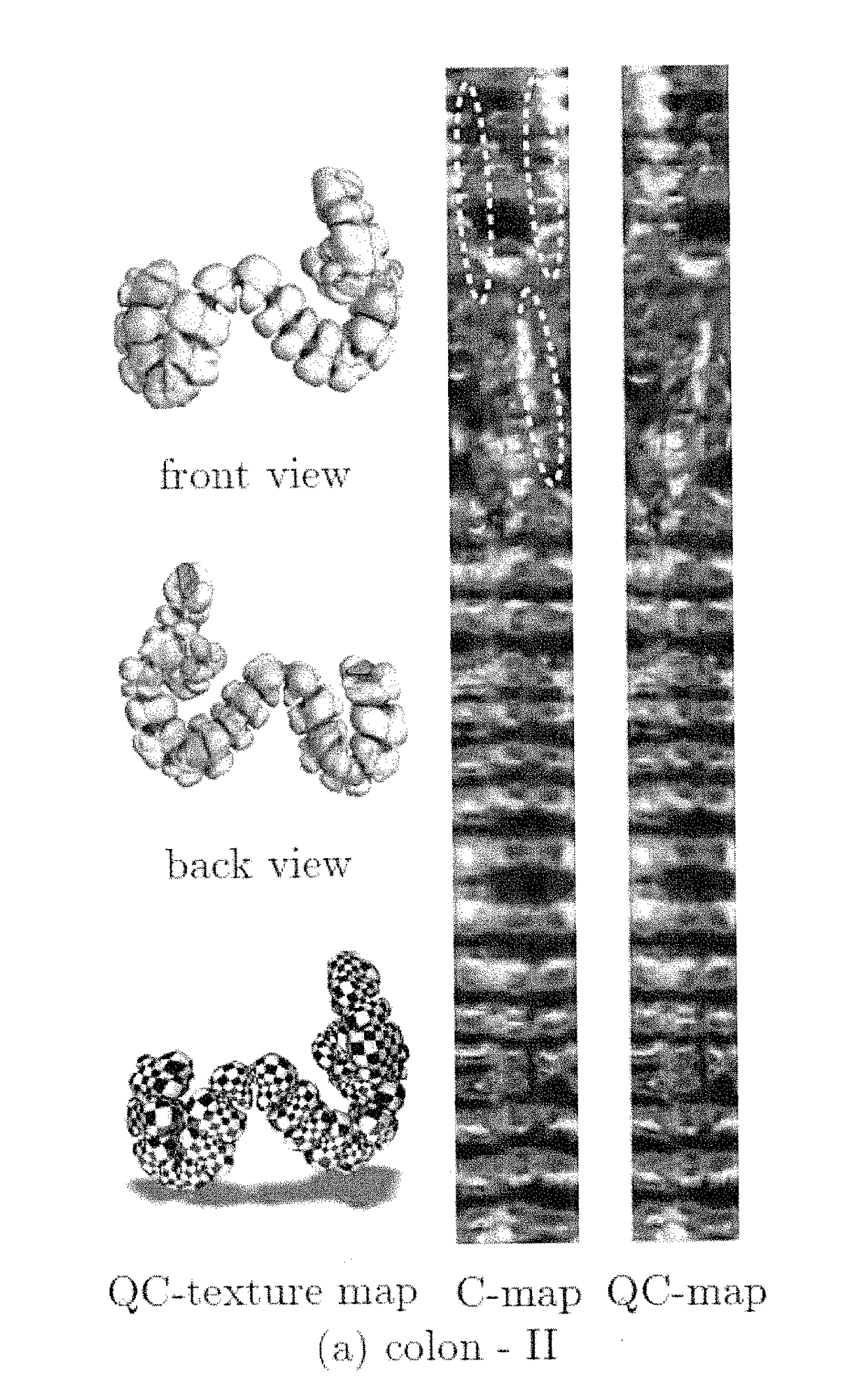 Systems and methods for shape analysis using landmark-driven quasiconformal mapping