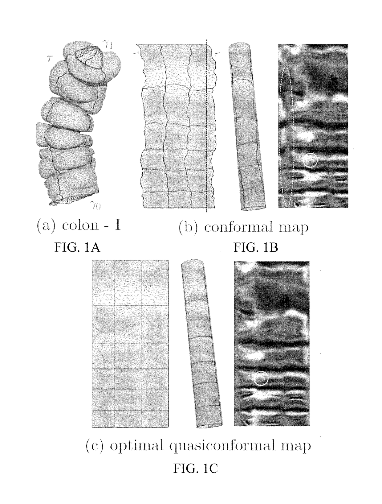 Systems and methods for shape analysis using landmark-driven quasiconformal mapping