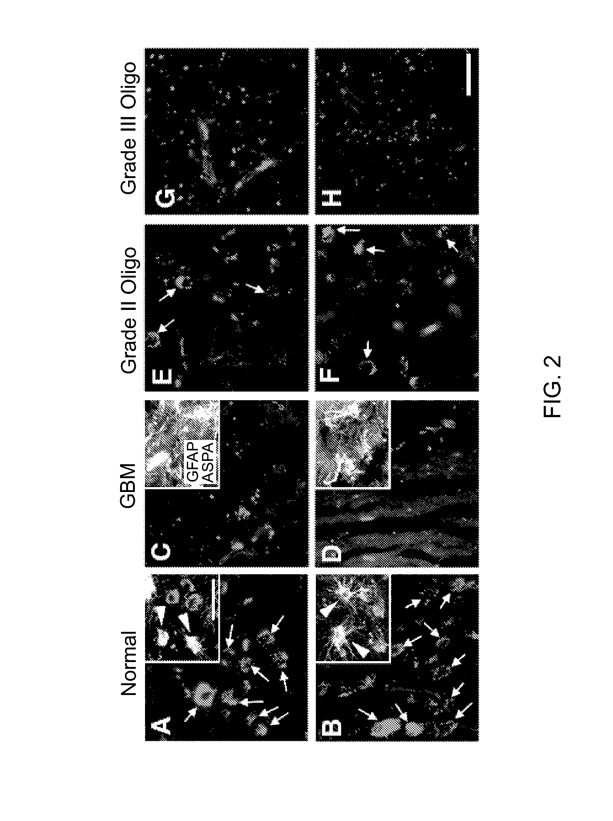Methods and compounds for treating cancer