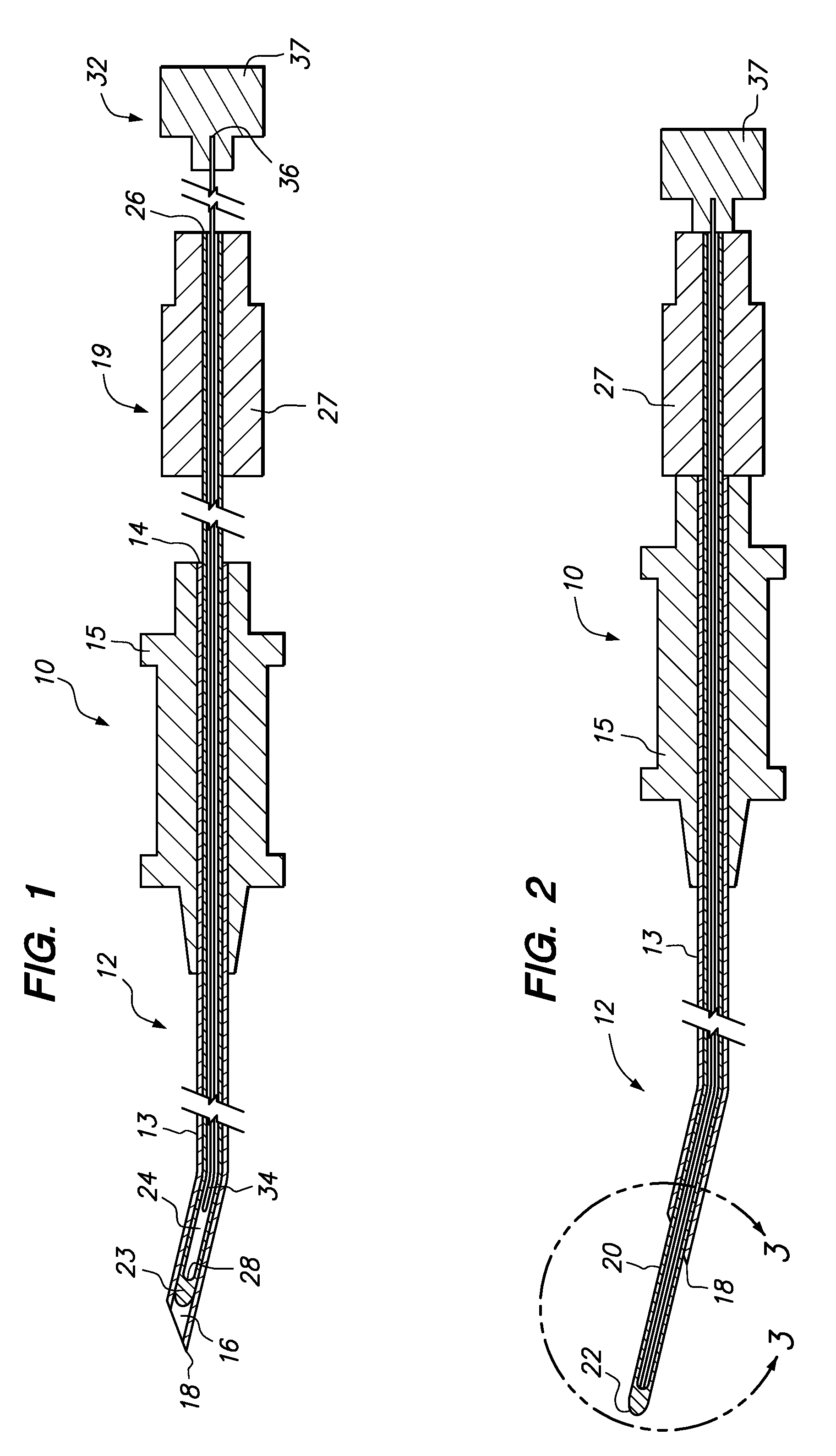 Epidural radiofrequency catheter for effectuating RF treatment in spinal canal and method of using same