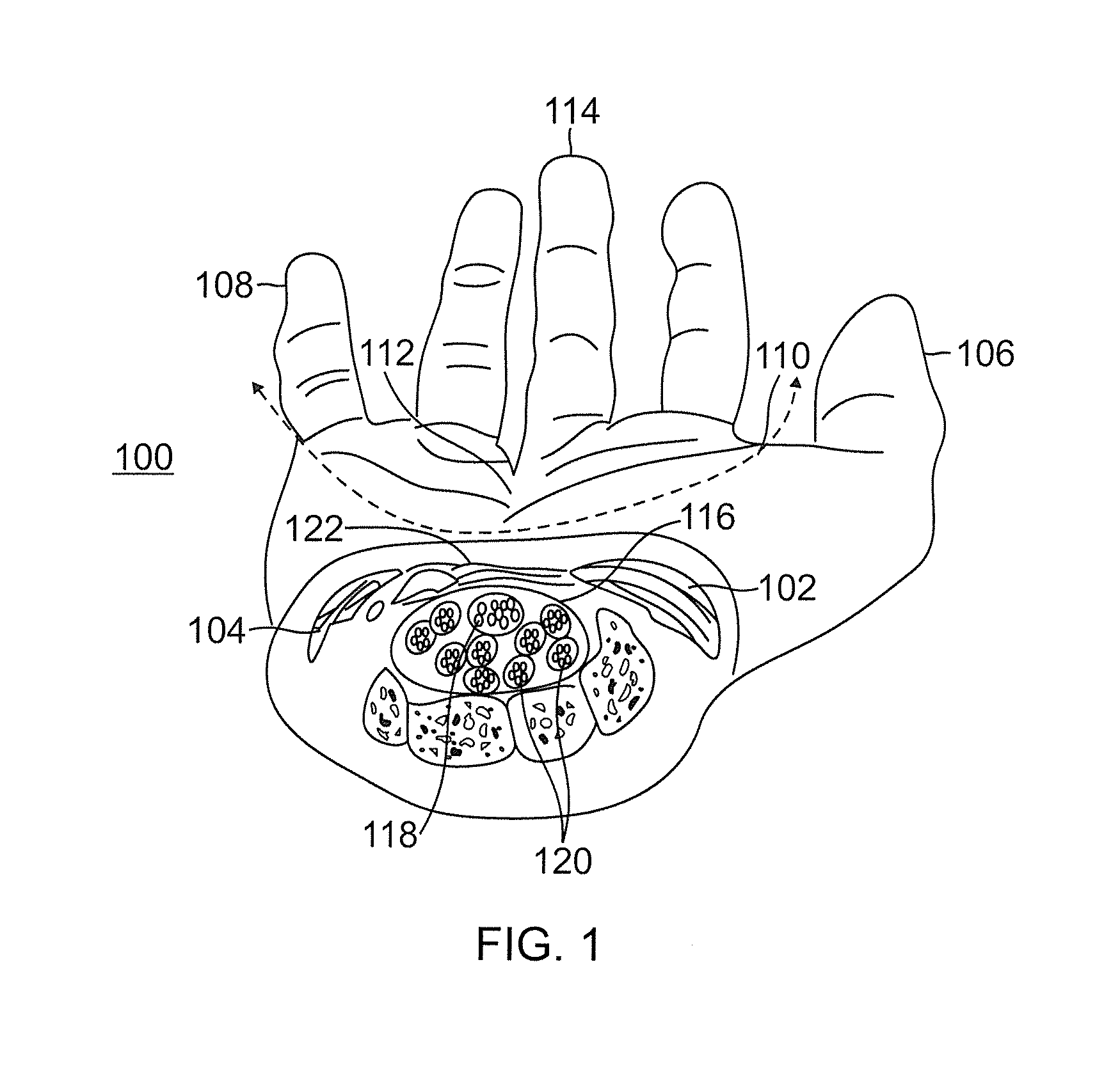 Therapeutic skin lifting device and related systems and methods