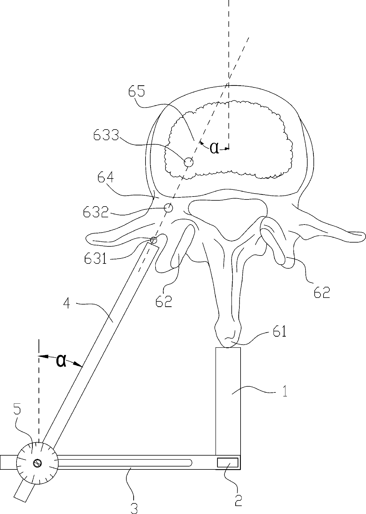 Pedicle positioning and guiding device for percutaneous vertebroplasty and operation method thereof
