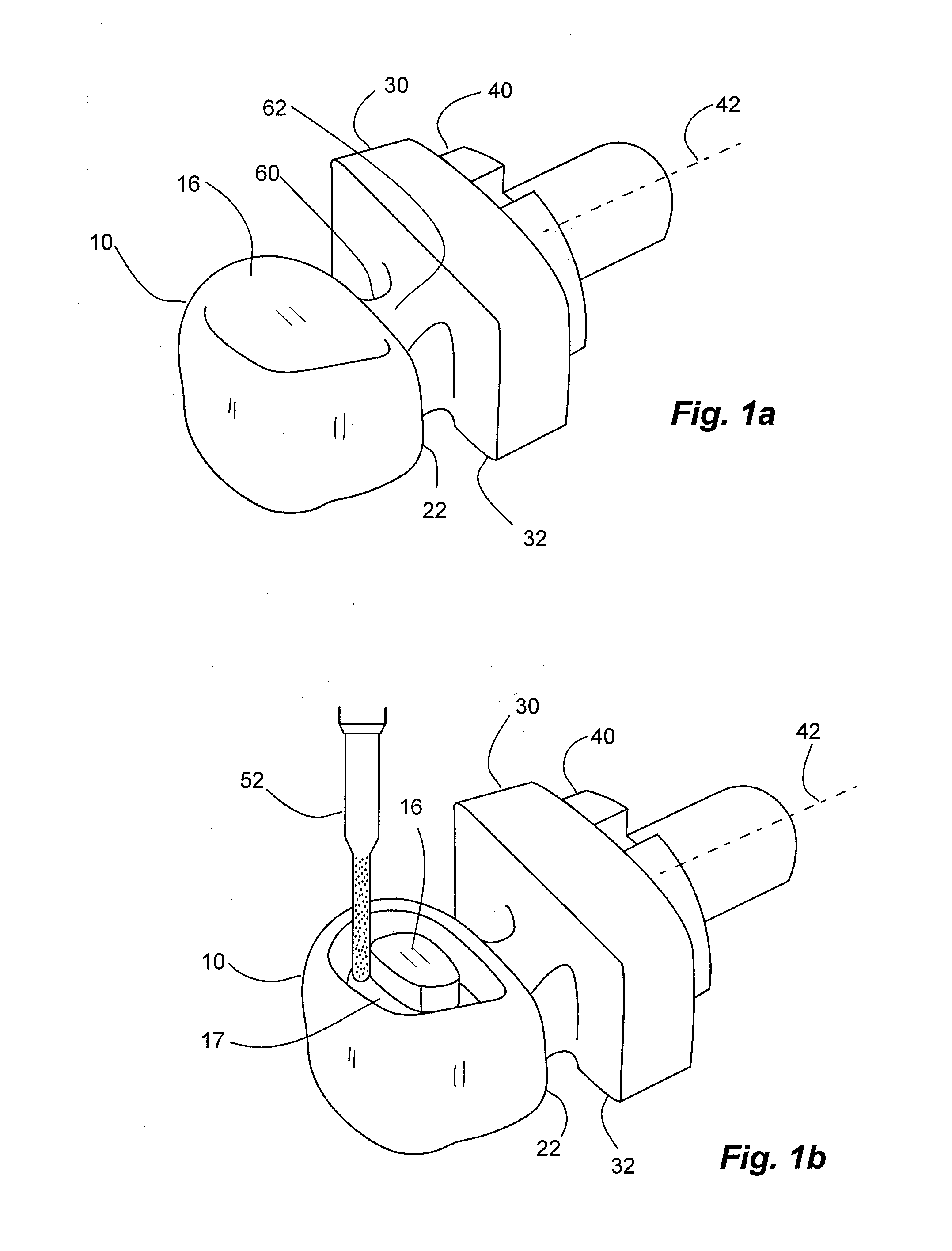 Method for machining a dental prosthesis