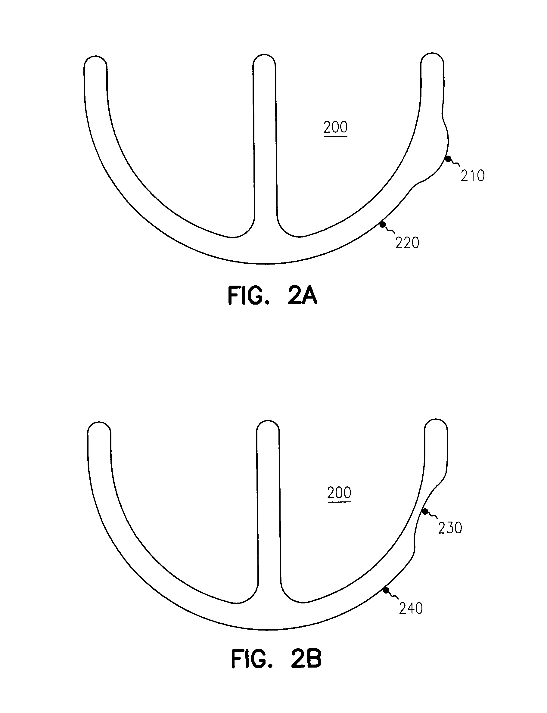 Apparatus and method for reversal of myocardial remodeling with electrical stimulation