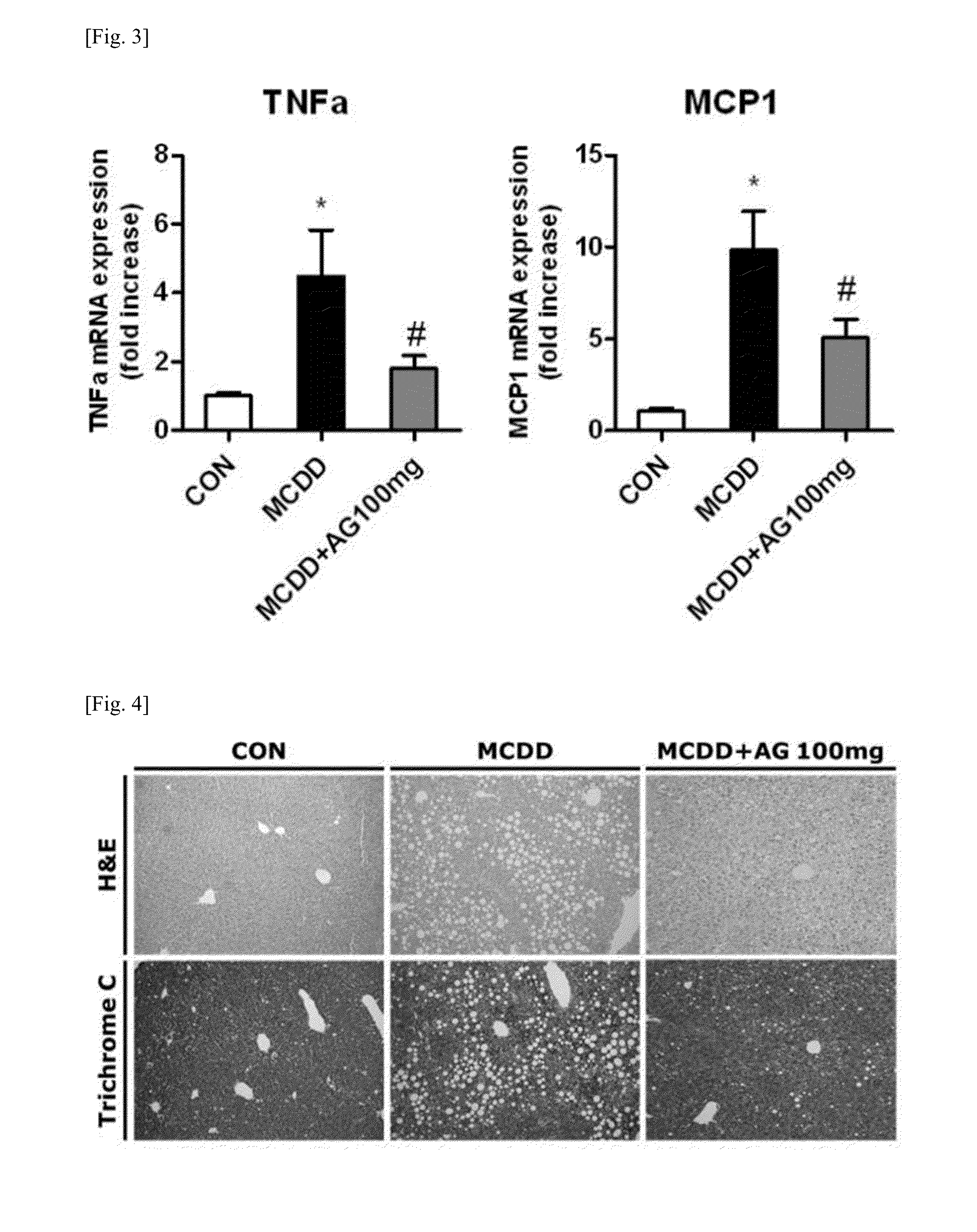 Pharmaceutical composition for preventing or treating liver diseases, containing plasmalogen precursor, plasmalogen or plasmalogen analog as effective component