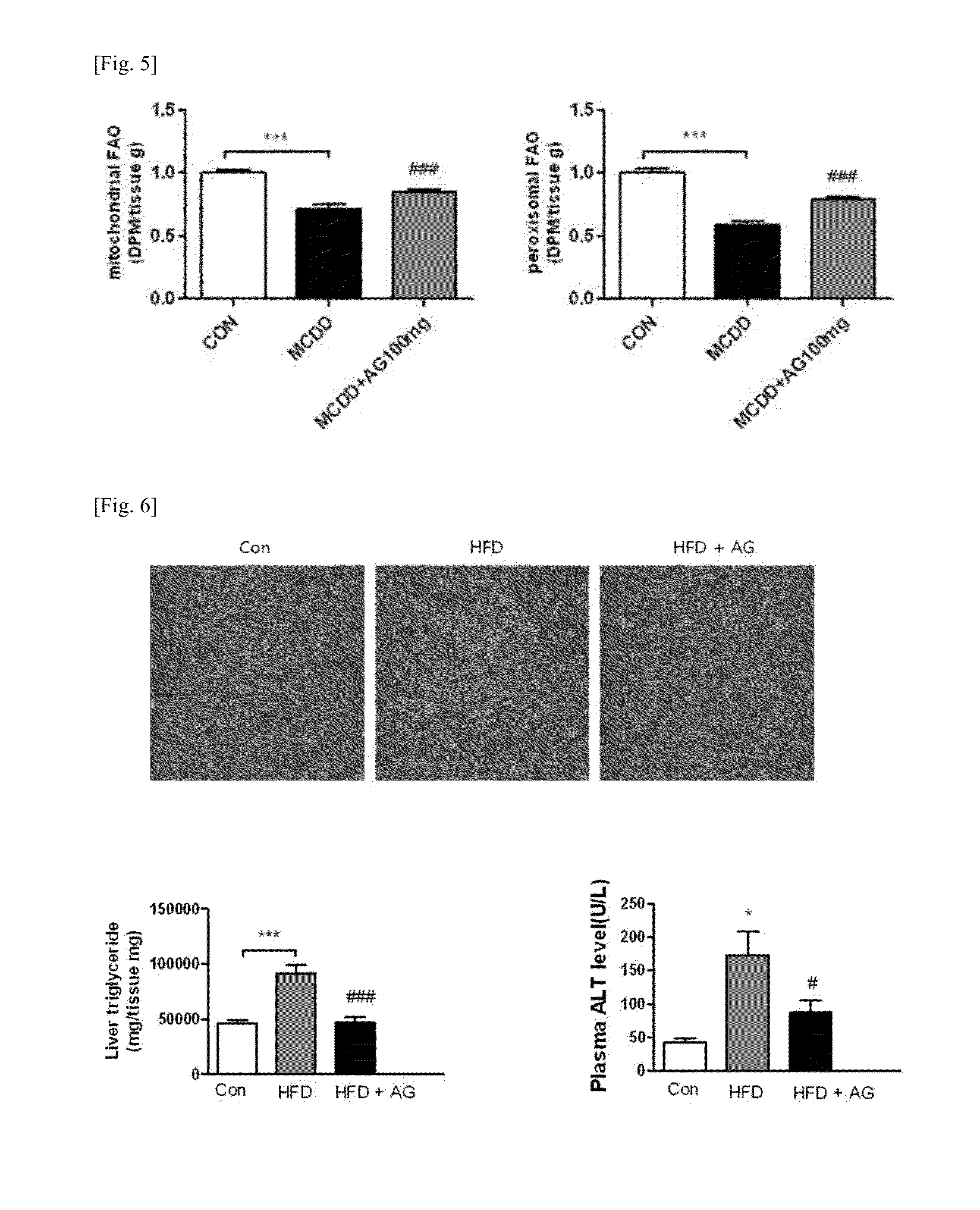 Pharmaceutical composition for preventing or treating liver diseases, containing plasmalogen precursor, plasmalogen or plasmalogen analog as effective component
