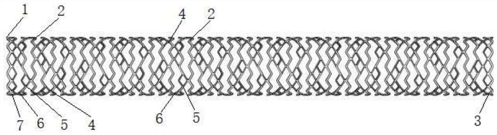 Stent for peripheral blood vessels