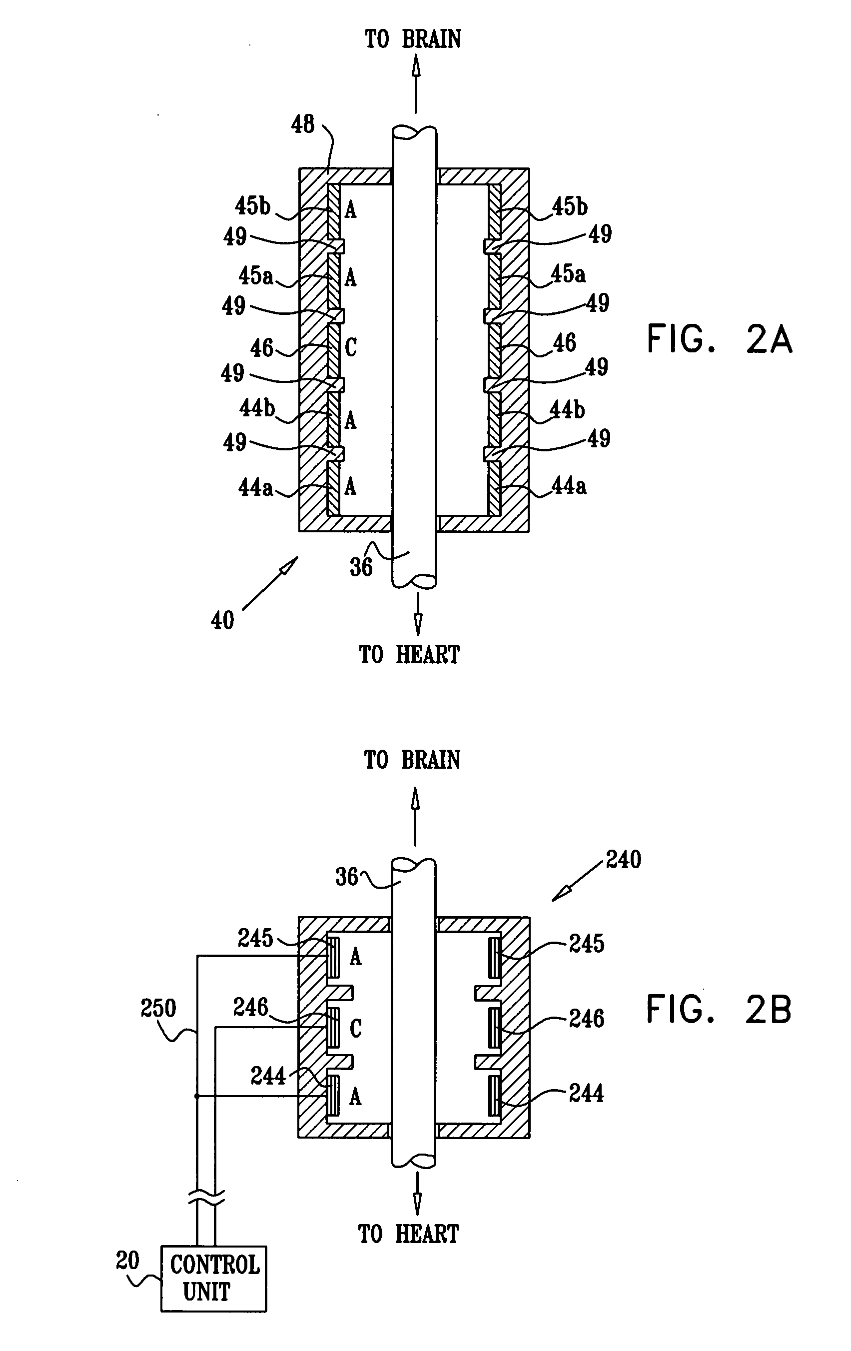 Selective nerve fiber stimulation for treating heart conditions