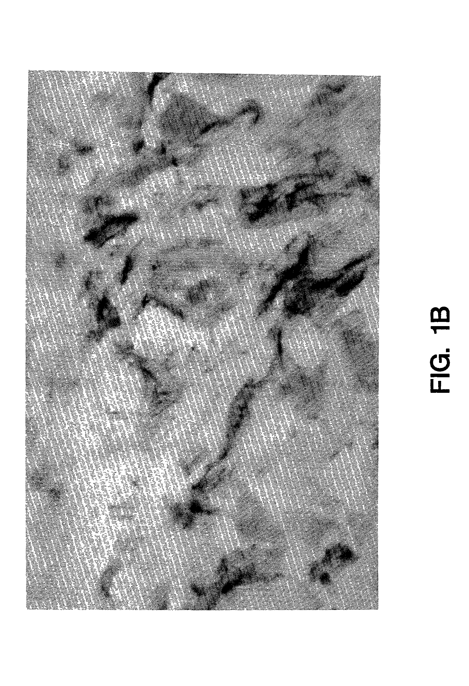 Methods for the treatment of coagulation disorders with lipoprotein associated coagulation inhibitor (LACI)
