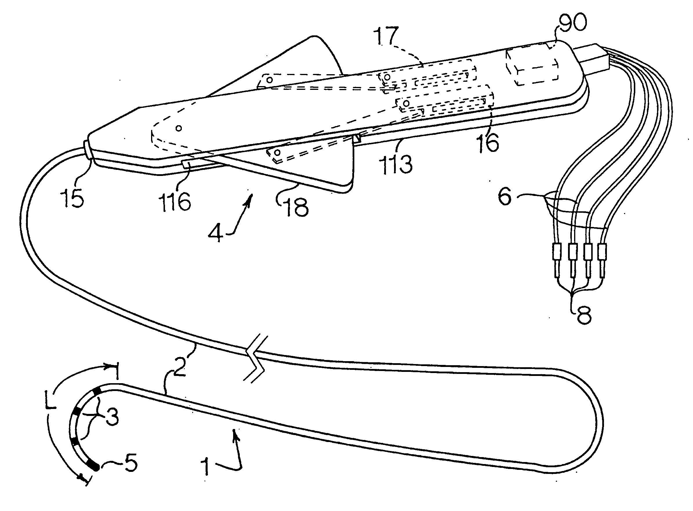 Electrophysiology/ablation catheter and remote actuator therefor
