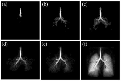 An Adaptive Highly Undersampled Hyperpolarized Gas Lung Dynamic MRI Reconstruction Method