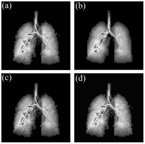 An Adaptive Highly Undersampled Hyperpolarized Gas Lung Dynamic MRI Reconstruction Method