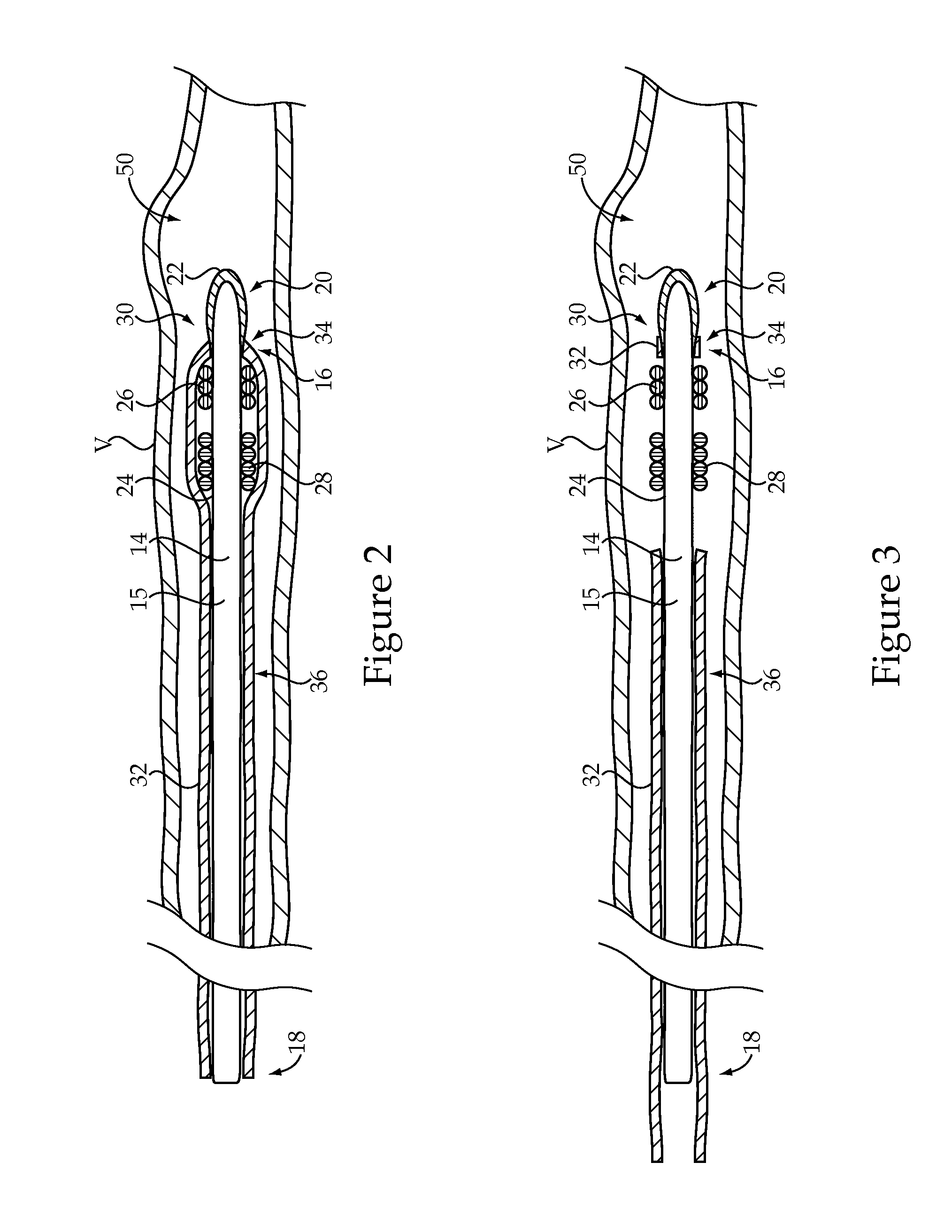 Embolic coil delivery system