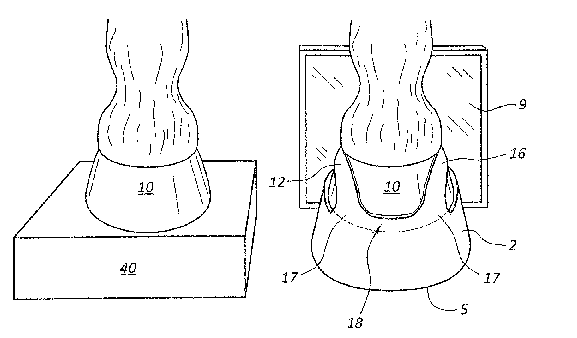Method And Apparatus For Positioning A Horse's Foot For Radiographic Examination