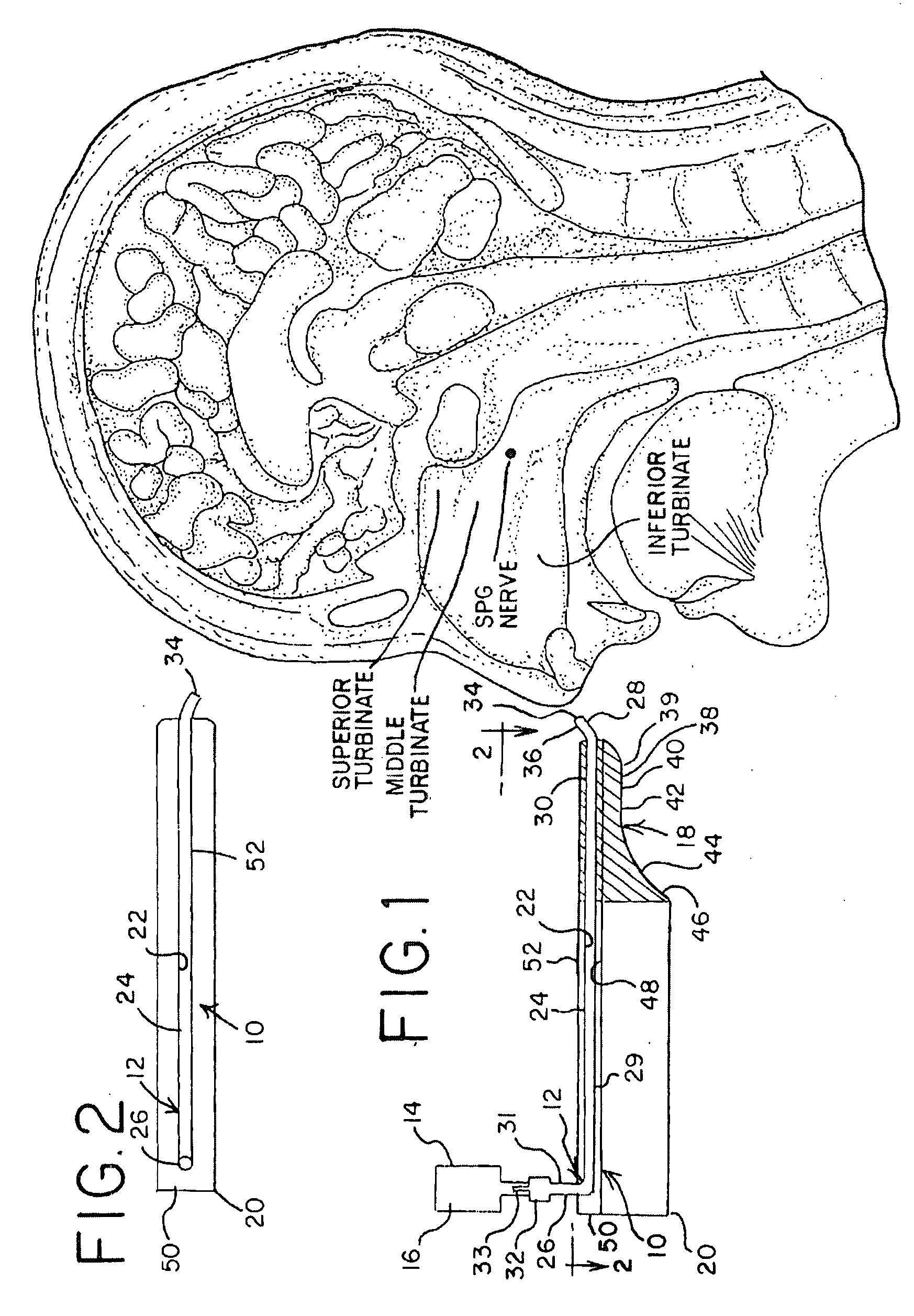 Apparatus and Method for Controlling Headaches