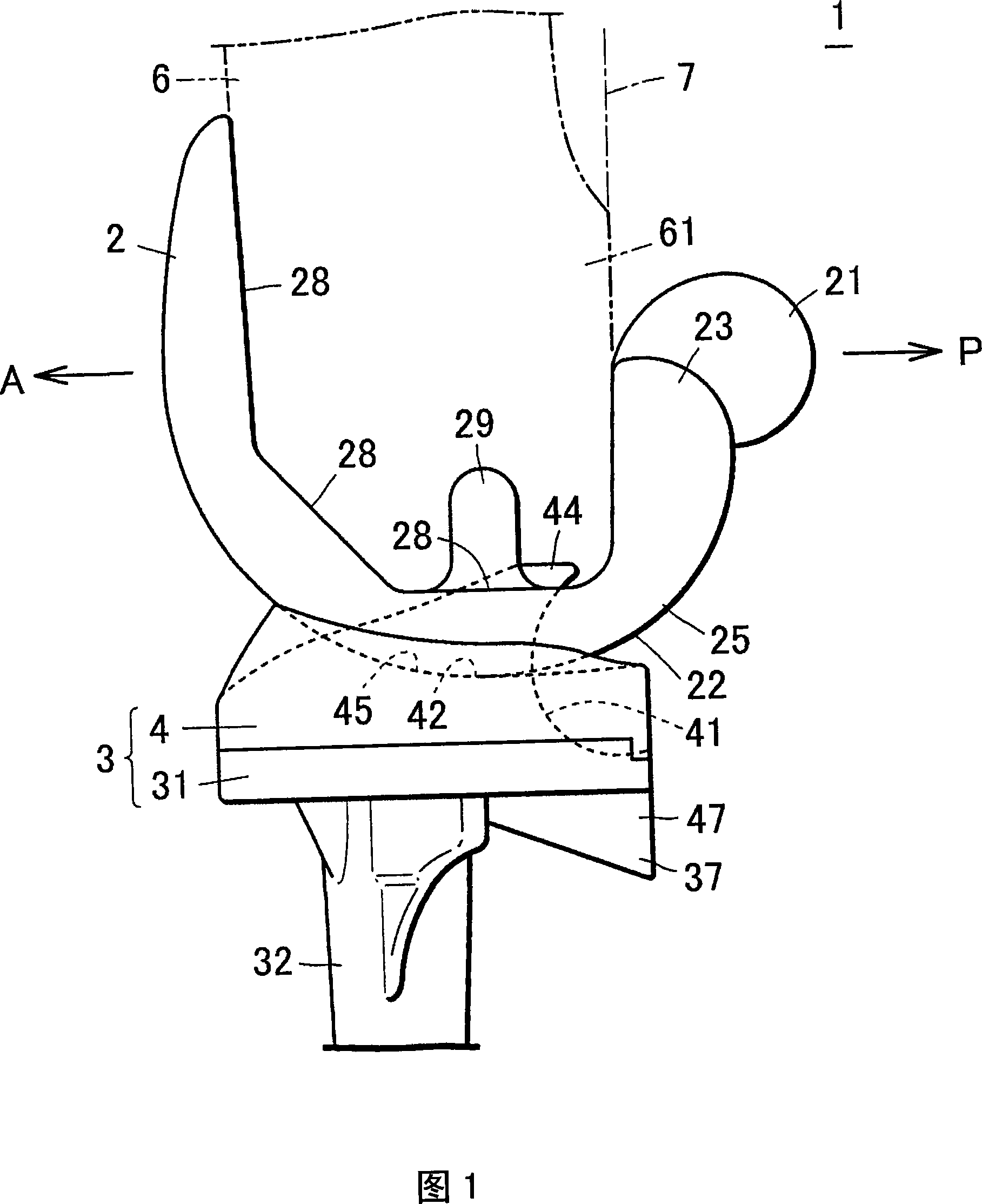 Artificial knee joint