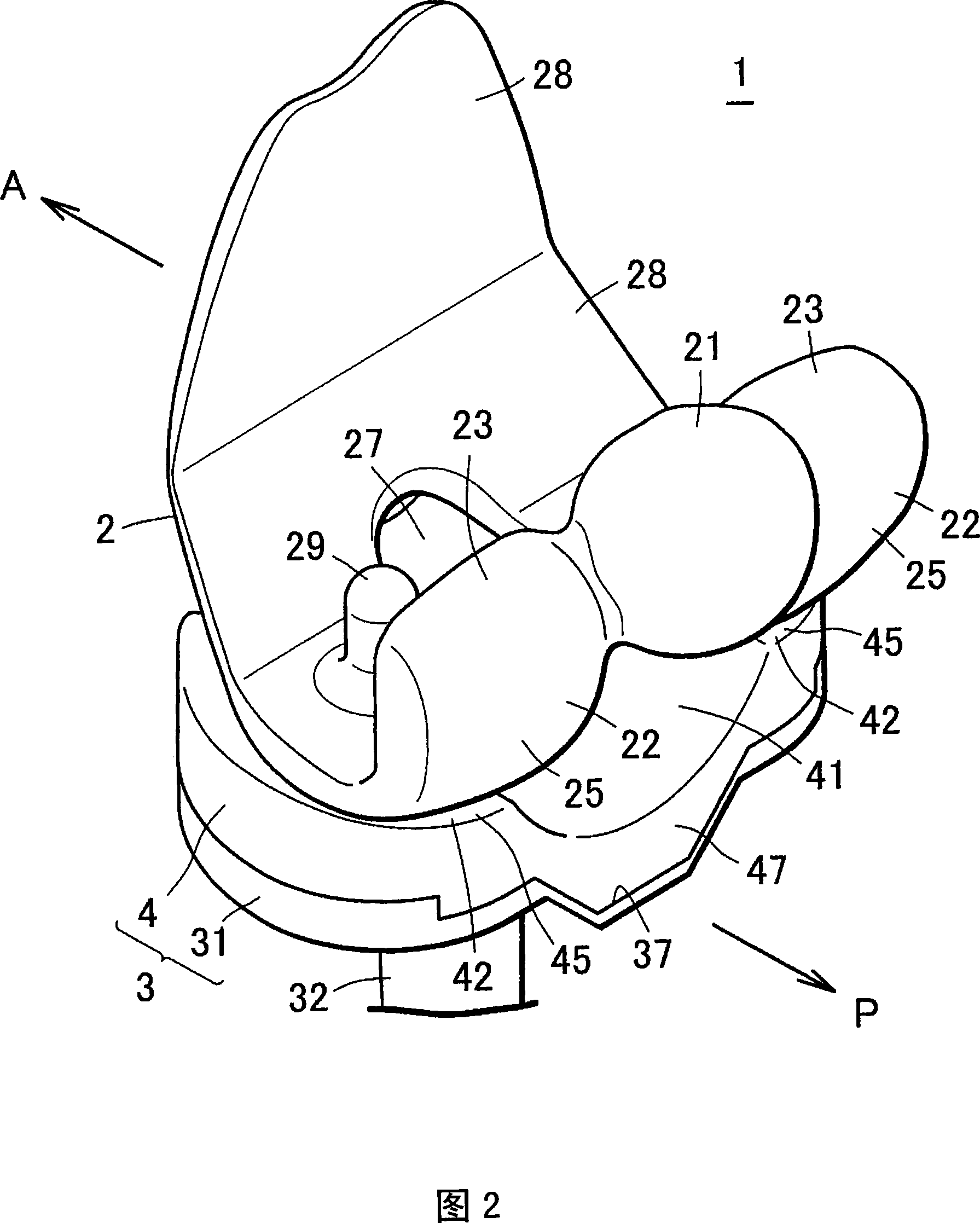 Artificial knee joint