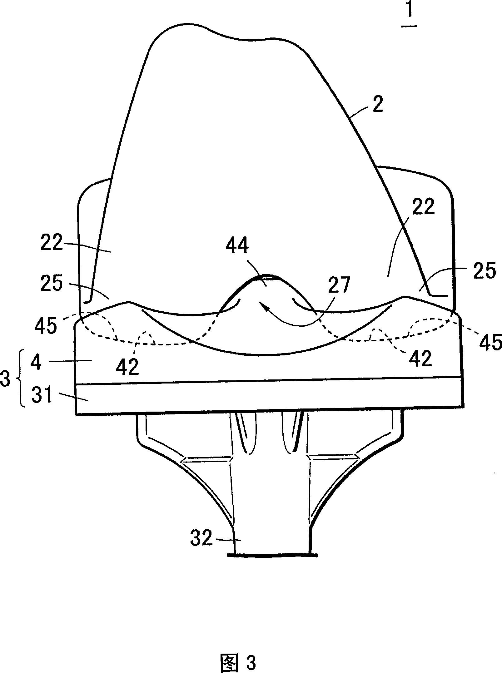 Artificial knee joint