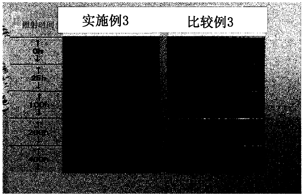 Surface treatment agent for dyed anode oxidized film of aluminum or aluminum alloy, and surface treatment method, sealing treatment method, and article using said agent