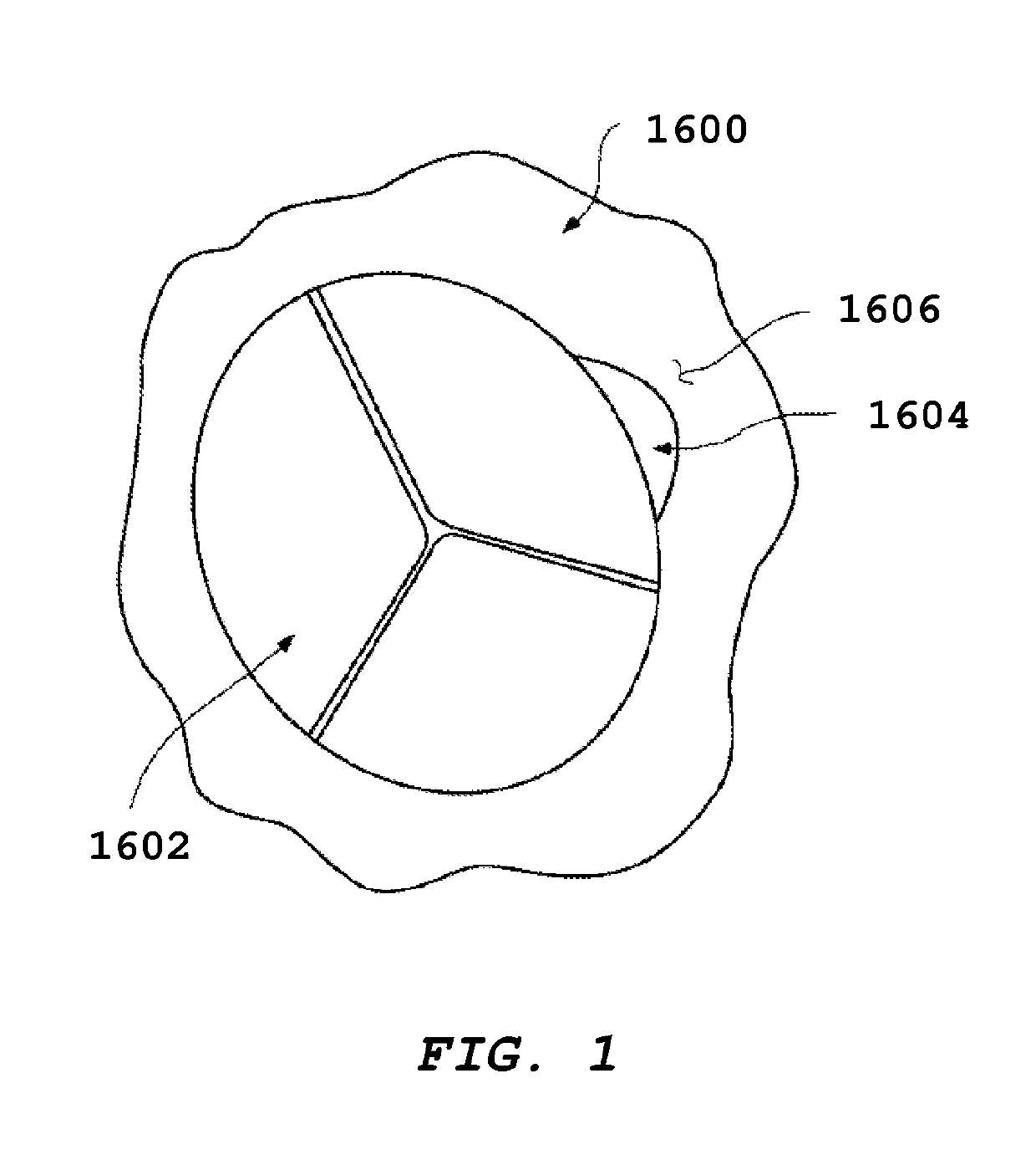 Devices for treating paravalvular leakage and methods use thereof