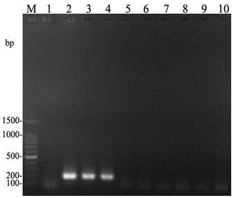 Prunus salicina acalitus phloeocoptes PCR detection primer and detection method thereof