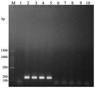 Prunus salicina acalitus phloeocoptes PCR detection primer and detection method thereof
