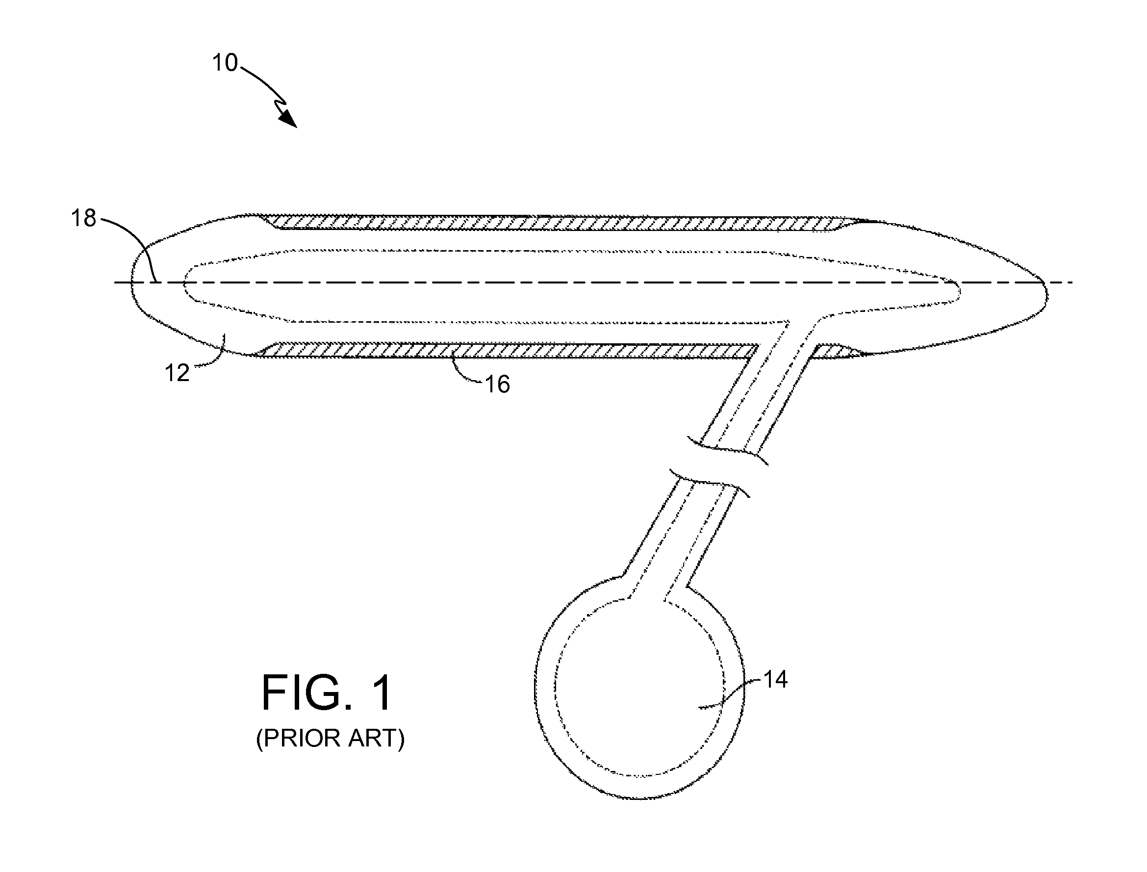 Corrugated expansion-constraining sleeve for an inflatable penile prosthesis cylinder