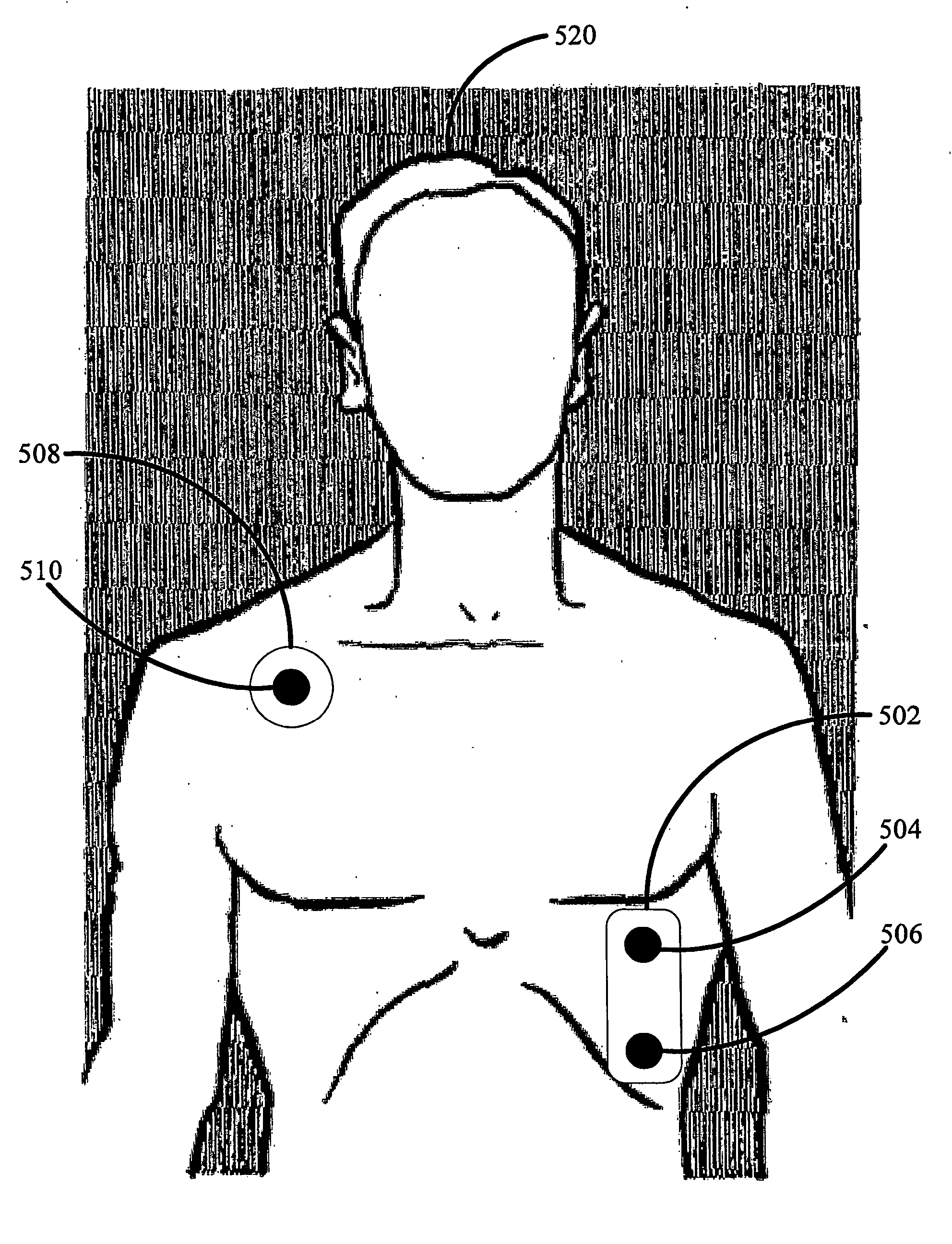 Egg monitoring methods and apparatus
