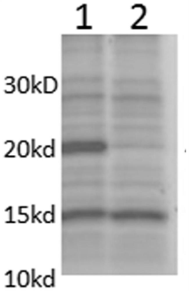 A human rotavirus vp8 recombinant protein and a human rotavirus vaccine using the vp8 recombinant protein