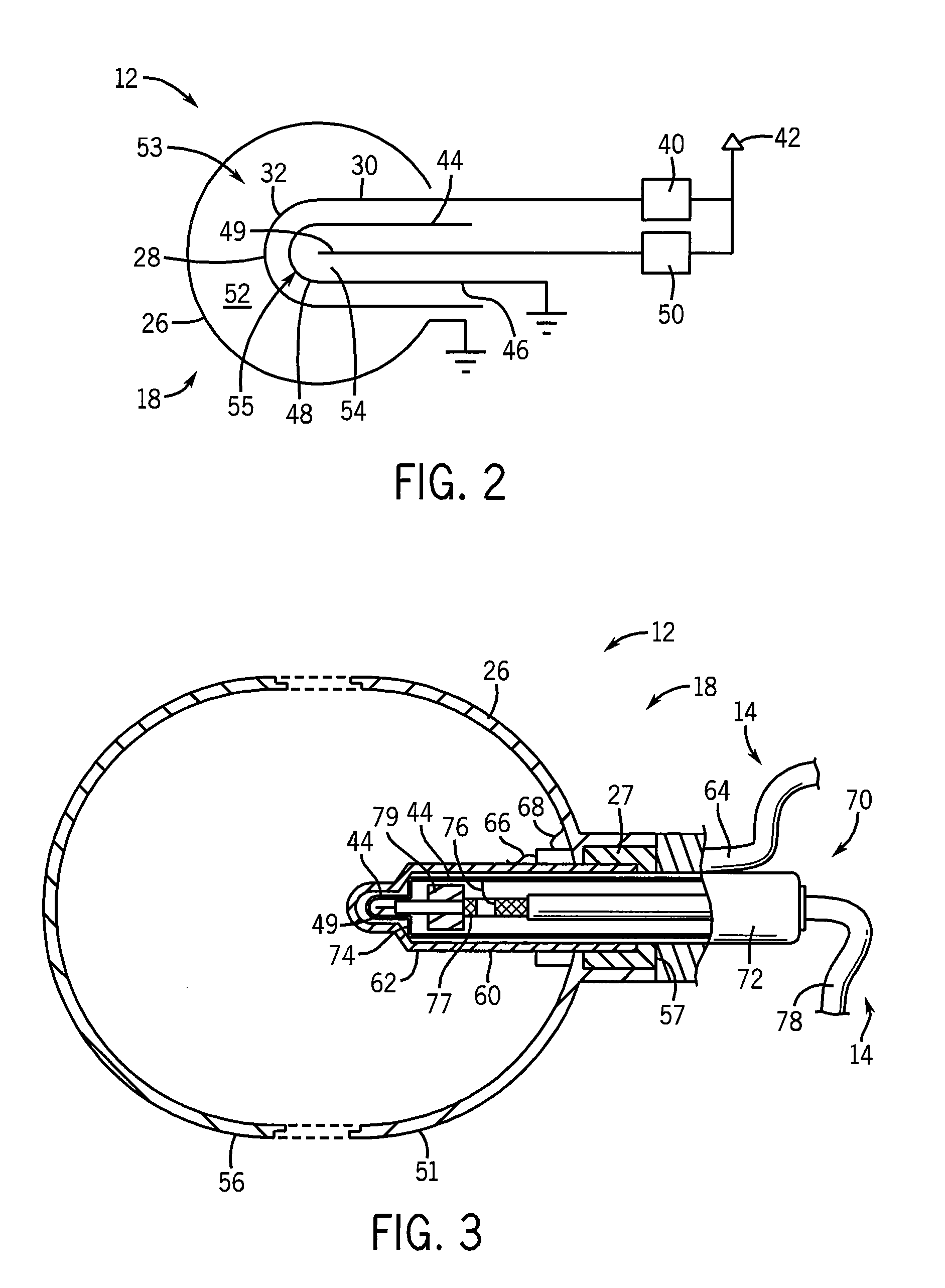 High-Resolution Ion Chamber