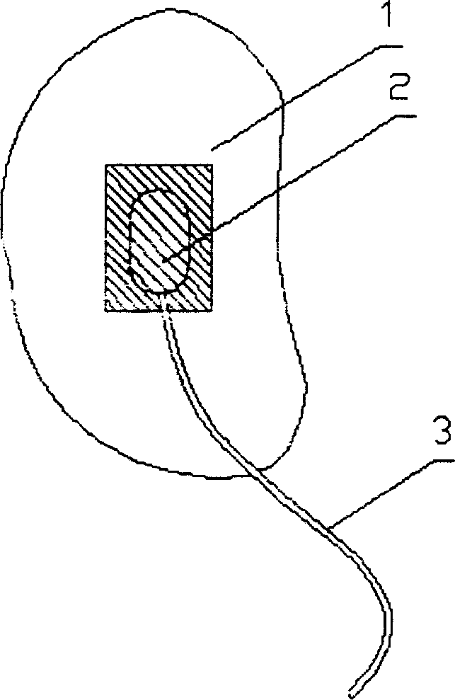 Synchronous analyzer for detecting signal of blood stream from nystagmus image and ear ending