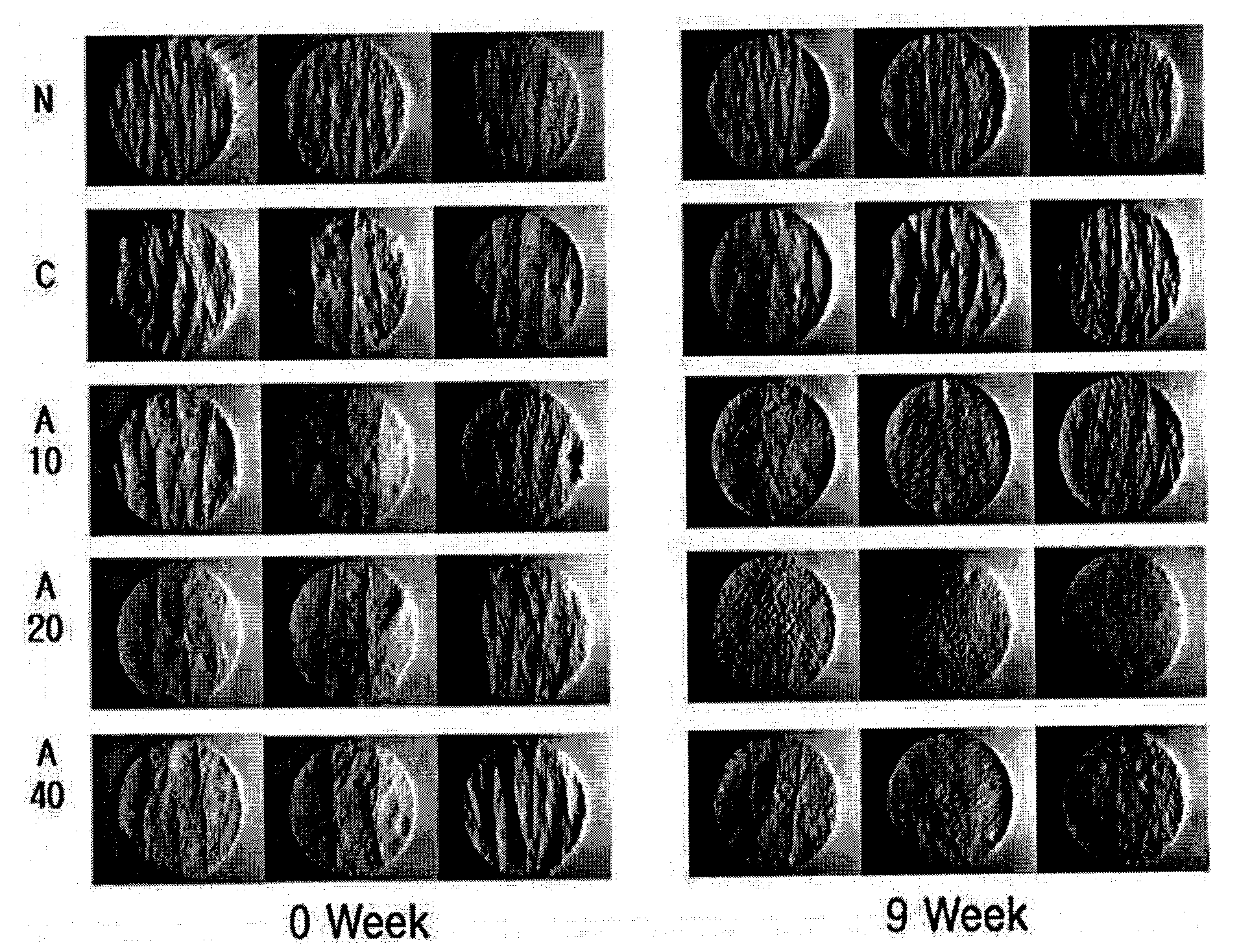 Composition for Skin Whitening and Wrinkle Improvement Comprising Vaccinium Uliginosum Extract and Method for Preparation Thereof