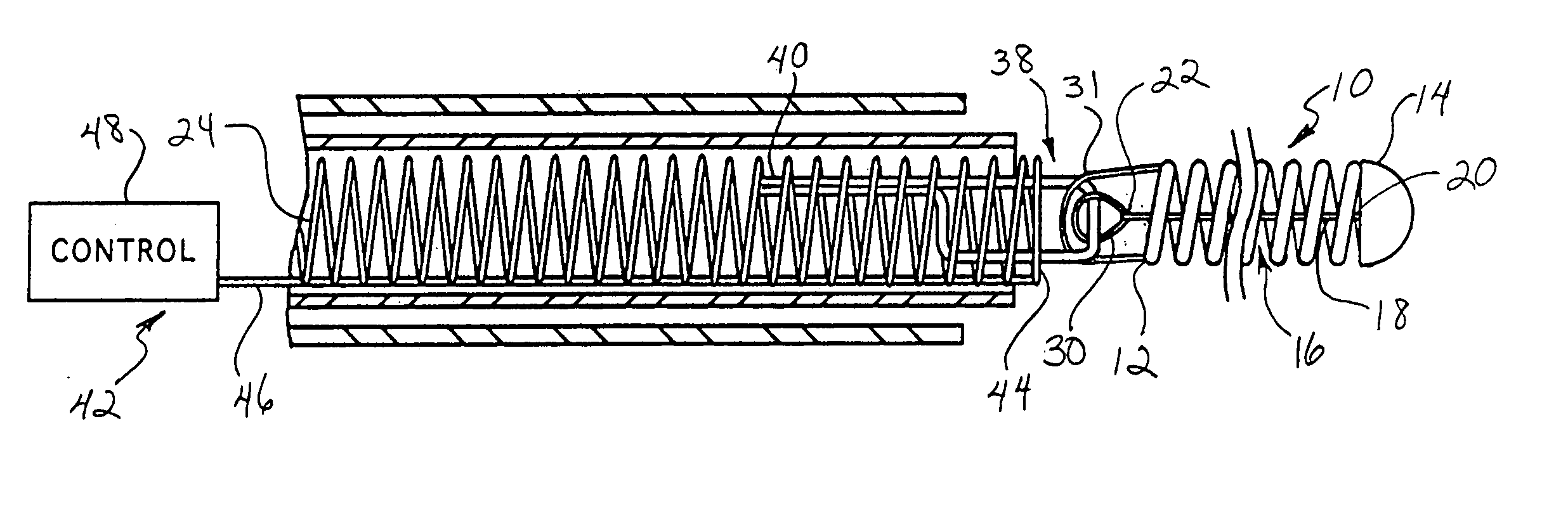 Stretch resistant therapeutic device