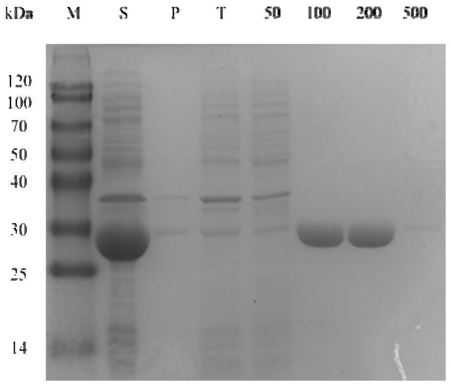 Alcohol dehydrogenase mutant with improved activity and stereoselectivity, recombinant vector of alcohol dehydrogenase mutant, genetically engineered bacterium containing recombinant vector, and application of alcohol dehydrogenase mutant and genetically engineered bacterium