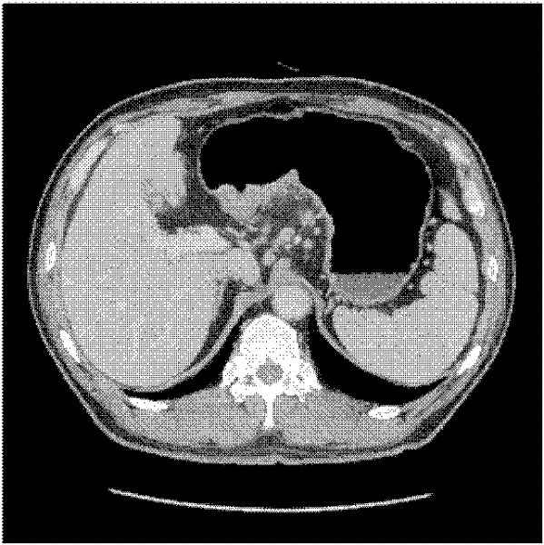 Stomach computed tomography (CT) sequence image segmentation method based on interactive region growth