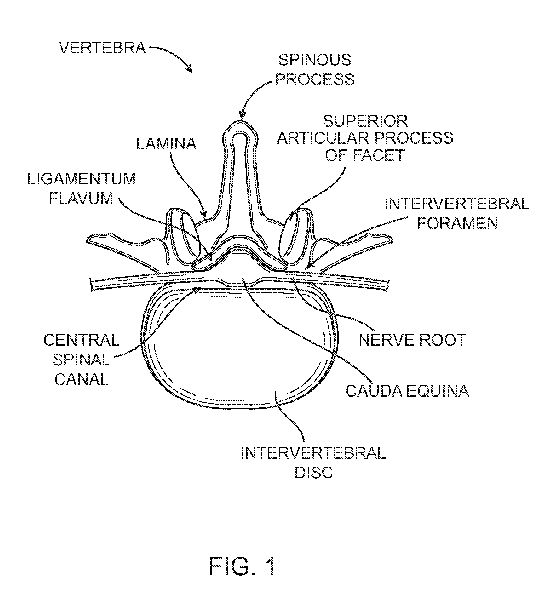 Tissue access guidewire system and method